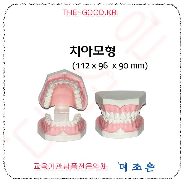 치아모형.jpg
